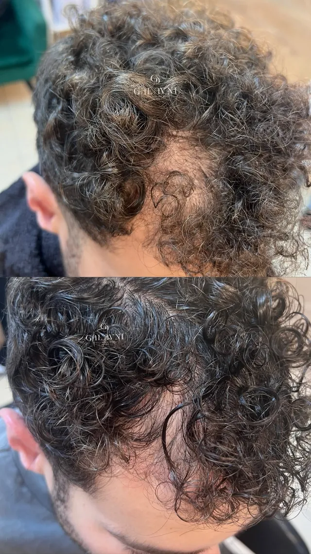 תוצאת טיפול, לפני ואחרי 08